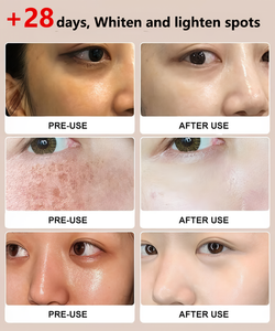 Niacinamide Purifying Whitening Cleanser(BUY 1 GET 1 FREE)