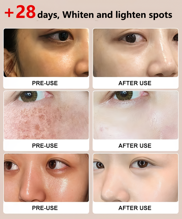 Niacinamide Purifying Whitening Cleanser(BUY 1 GET 1 FREE)
