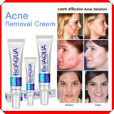 BIOAQUA FACE CREAM ANTI ACNE TREATMENT