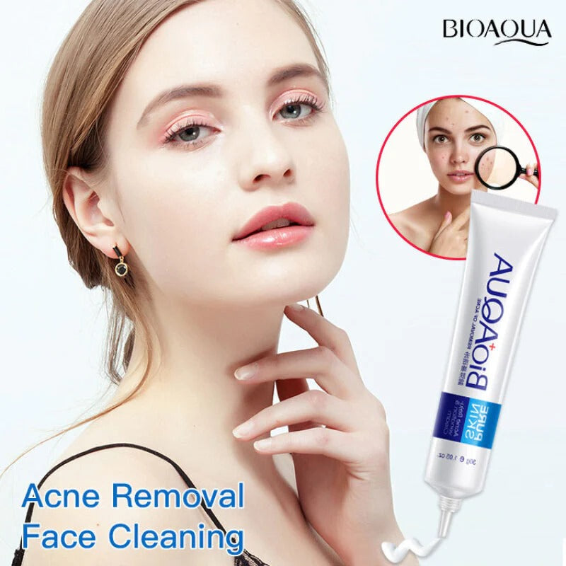 BIOAQUA FACE CREAM ANTI ACNE TREATMENT