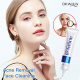 BIOAQUA FACE CREAM ANTI ACNE TREATMENT